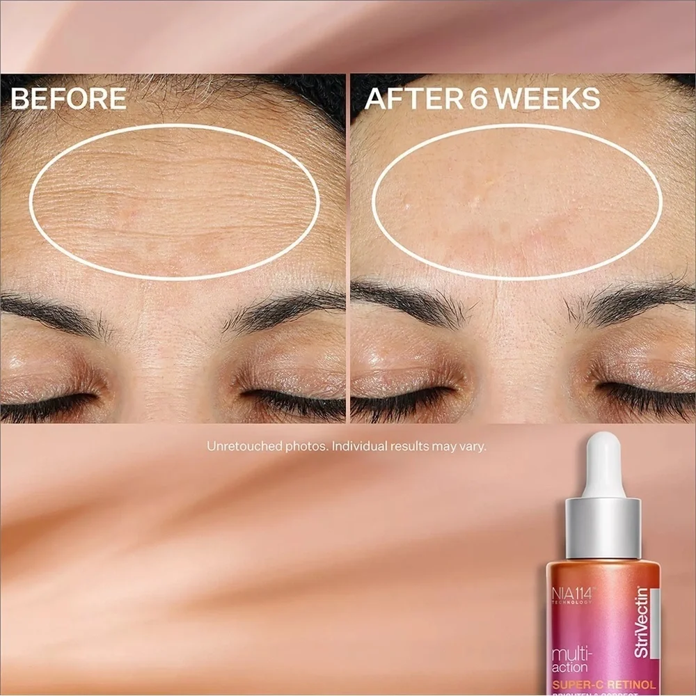 StriVectin Multi-Action Super-C Retinol Brighten & Correct Vitamin C Serum 1oz
